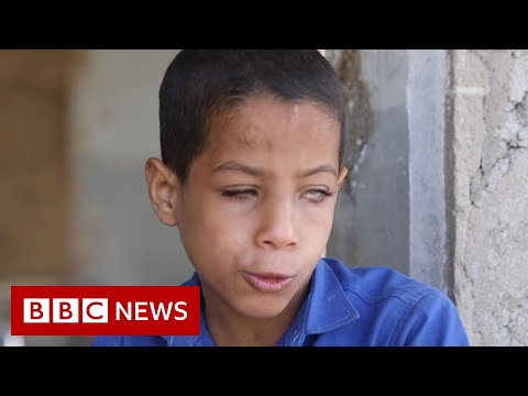 Yemen’s blind nine-year-old war-zone school teacher – BBC News