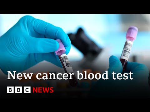 Blood test for more than 50 cancers ‘shows promise’ in study – BBC News